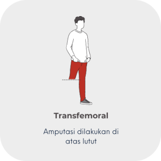 1 Amputation level - 3 transfemoral MY
