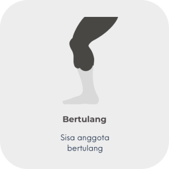 3 shape res limb - 2 bony MY