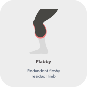 3 shape res limb - 3 flabby